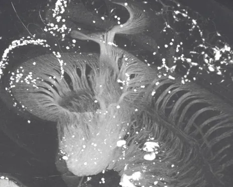 Human auditory nerve Human auditory nerve
